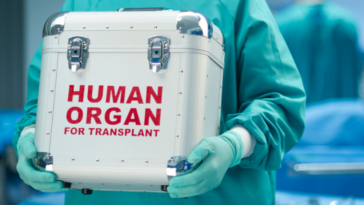 Organ transplant