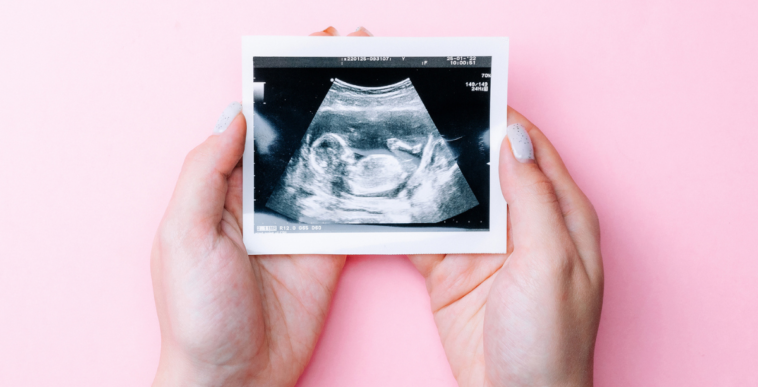 Woman holding an ultrasound picture